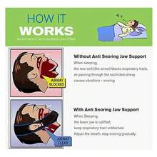 Set De Productos Anti-ronquidos De Silicona 10 Pack - Bálsamo - Ver 4