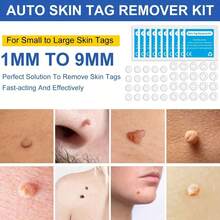 2 In 1 Auto Skin Tag Removal Kit Painless Mole Wart Remover Equipment Micro 1-9mm Treatment Tool Easy To Clean Skin Care Tool - Blue - View 4
