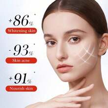 Whitening And Anti-Freckle Cream, Spot Removal, Moisturizing And Whitening Cream For Men And Women - Nhiều màu 1 - Xem 4