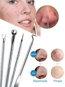 5件套银色祛痘针套装，黑头粉刺去除针，粉刺挤压器，美容针，祛痘夹，黑头镊子，美容工具