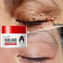 Whitening And Anti-Freckle Cream, Spot Removal, Moisturizing And Whitening Cream For Men And Women - Nhiều màu 1 - Xem 1