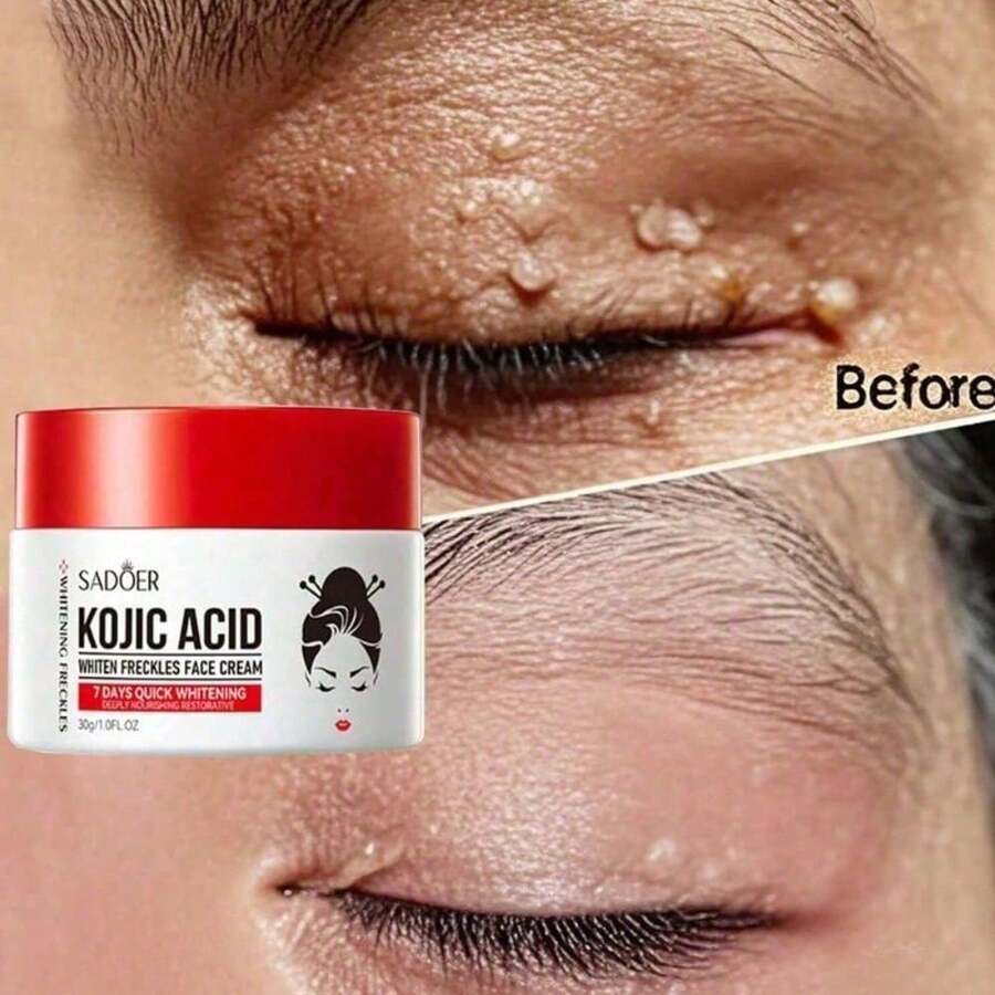 Whitening And Anti-Freckle Cream, Spot Removal, Moisturizing And Whitening Cream For Men And Women - Nhiều màu 1 - Xem 1