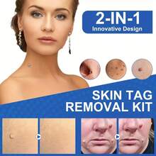 2 In 1 Auto Skin Tag Removal Kit Painless Mole Wart Remover Equipment Micro 1-9mm Treatment Tool Easy To Clean Skin Care Tool - Blue - View 3