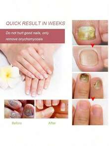 Let You Have Healthy Nails - 1 Item - View 6