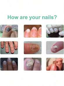 Let You Have Healthy Nails - 1 Item - View 4