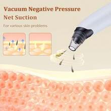 Blackhead Remover Vacuum - Powerful Pore Vacuum For Cleansing Blackhead Extractor With 3 Adjustable Suction Levels 4 Blackhead Removal Tools USB Rechargeable Suitable For Women And Men - White - View 5