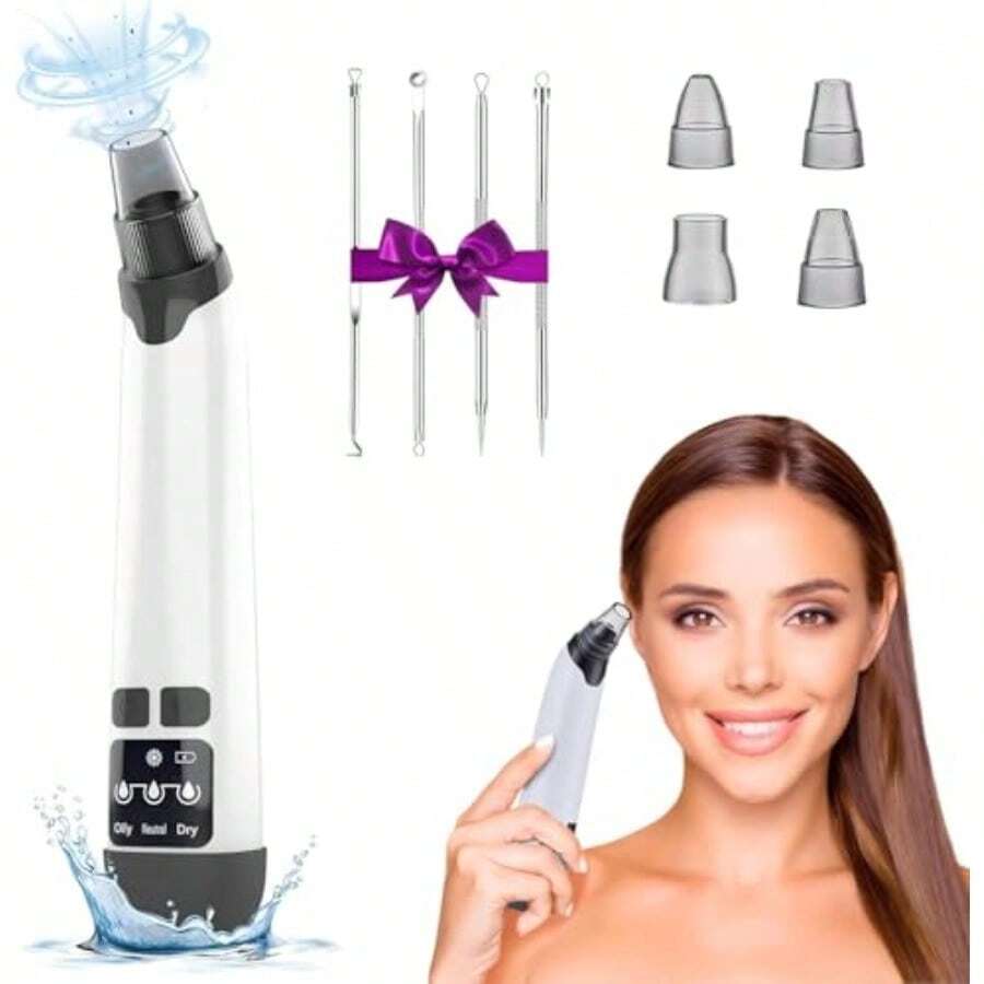 Blackhead Remover Vacuum - Powerful Pore Vacuum For Cleansing Blackhead Extractor With 3 Adjustable Suction Levels 4 Blackhead Removal Tools USB Rechargeable Suitable For Women And Men - White - View 1
