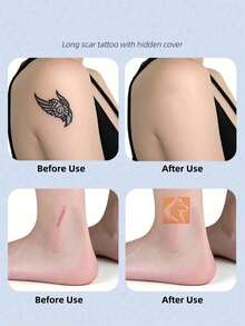 Silicone Scar Sheets - Gentle, Washable, Reusable, Suitable For Surgical Scars, C-Section Scars And Hypertrophic Scars - Soft, Breathable, Waterproof Silicone Scar Sheets, Effective Scar Management - Multicolor - View 8