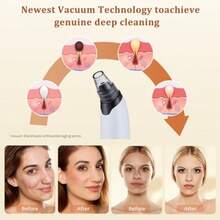 Blackhead Remover Vacuum - Powerful Pore Vacuum For Cleansing Blackhead Extractor With 3 Adjustable Suction Levels 4 Blackhead Removal Tools USB Rechargeable Suitable For Women And Men - White - View 3