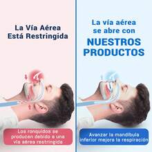 Guarda dental anti ronquidos, detiene el ronquido y el bruxismo,,Guarda dental bruxismo, Guarda dental bruxismo, mejora la calidad del sueño, Libre de BPA y Látex,Protector dental que ayuda a dormir - Una pieza - Ver 4