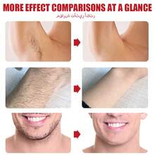 ROZINO Hair Removal Cream With Nourishing Coconut Oil - Gentle, Effective Face & Body Hair Remover For Men And Women - Smooth Texture Formula For Easy Application On Legs, Underarms, Chest & Hands - Refreshing, Non-Irritating Hair Removal Treatment, 100g/3.527oz - F-097 - 查看 4