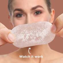 Pimple Patches (6 Sizes 138 Patches), Acne Patches For Large Zit Breakouts, Hydrocolloid Bandages For Face, Chin, Nose, Forehead, Body, Back, Neck & Chest, Oval Hydrocolloid Acne Patches - 6 kích cỡ (138 miếng vá) - Xem 9