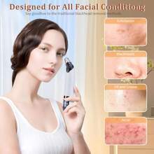 Blackhead Remover Vacuum - Powerful Pore Vacuum For Cleansing Blackhead Extractor With 3 Adjustable Suction Levels 4 Blackhead Removal Tools USB Rechargeable Suitable For Women And Men - White - View 2