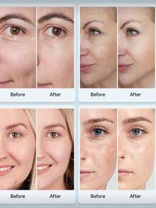 7色LED光疗面膜，LED光疗仪，红光疗法，适合所有肤质，面部护理工具，红光面膜，400mAh锂电池（白色面膜） - 白色 - 查看 8