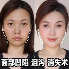 Baby & Kids Face Cream - 1000g - View 2