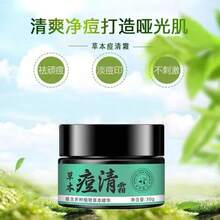 Crema de Tratamiento Herbal para el Acné para la Eliminación de Acné, Desvanecimiento de Marcas de Acné, Control de Espinillas, Control de Grasa, Minimización de Poros, Crema de Tratamiento Suave para el Acné - Crema herbal para el acné 30 g - Ver 5