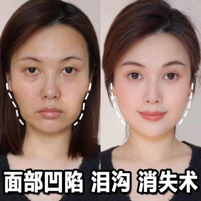 Crema de Relleno de Colágeno Reestructurado, Molécula Pequeña, Lifting, Reafirmante, Iluminadora, Hidratante, Antiarrugas, Crema de Esencia Rejuvenecedora