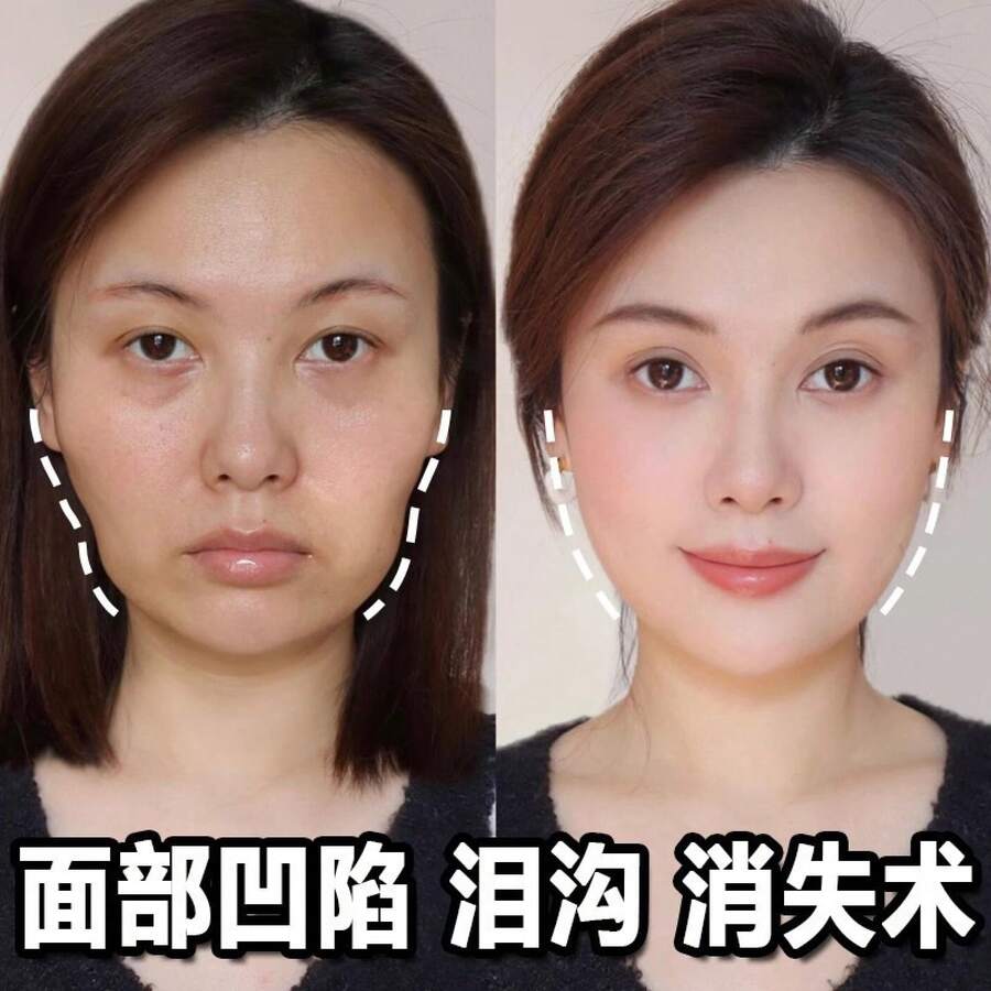 Baby & Kids Face Cream - 1000g - View 1