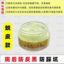 Crema de Control de Color Verde Controla el Reflujo de Pigmento Cuidado Anti-Piel Blanqueamiento Negro Aclaramiento de Pecas Iluminación de Melanina Salón de Belleza - Crema de control de pigmentación de 20 g (para hiperpigmentación post-imperfecciones) - Ver 4