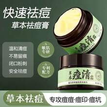 Crema de Tratamiento Herbal para el Acné para la Eliminación de Acné, Desvanecimiento de Marcas de Acné, Control de Espinillas, Control de Grasa, Minimización de Poros, Crema de Tratamiento Suave para el Acné - Crema herbal para el acné 30 g - Ver 3