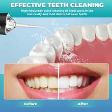 Electric Water Flosser Cordless For Teeth 3 Modes 4 Jet Tips Cleaning And Flossing Water Dental Portable Floss Irrigator Oral Water Flossed Rechargeable Tonsil Stone Travel Adults - 粉色 - 查看 5