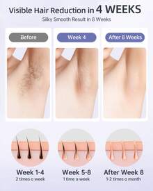 Purple IPL Epilator, HR/SC/RA 3-In-1 Hair Removal, 999,900 Flashes, 9 Adjustable Energy Levels, Suitable For Face, Arms, Legs And Bikini Area, Suitable For Gift Giving. - Xem 4