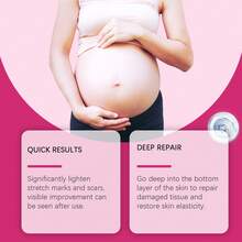 50g Loción de Cuidado Cutáneo Postparto para Mujeres, Limpieza Suave y Humectación Duradera, Nutre Piel Sensible Postparto, Ideal para Cuidado Diario - 50 g - Ver 8