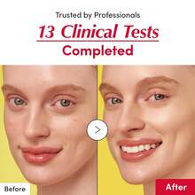 Vitamin C Brightening Serum With Niacinamide & Ceramides | Illuminating Face Serum, Hyaluronic Acid For Hydration, Strengthens Skin Barrier, 1.01 Fl Oz, Perfect Women's Gift For Holidays & Birthday - VCS-A - 查看 5