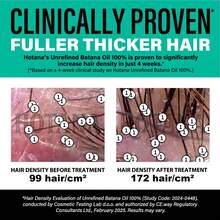 Aceite de Batana Crudo para el Cabello - 100% Puro, Orgánico, 4oz de Batana de Honduras para Cabello Grueso y Fuerte - Mascarilla Cosmética Desenredante y Sin Refinar Prensada en Frío del Dr. Sebi para Hombres y Mujeres (1 Unidad) - Ropa formal - Ver 9