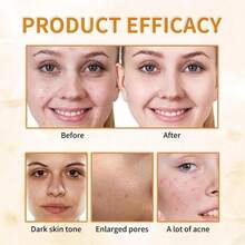 Tónico exfoliante de ácido glicólico al 7%, tónico facial exfoliante, tónico que aprieta los poros, suaviza y renueva la piel, iguala el tono y la fórmula hidratante - Beige - Ver 7