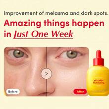 Vitamin C Brightening Serum With Niacinamide & Ceramides | Illuminating Face Serum, Hyaluronic Acid For Hydration, Strengthens Skin Barrier, 1.01 Fl Oz, Perfect Women's Gift For Holidays & Birthday - VCS-A - 查看 8