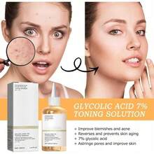 Tónico exfoliante de ácido glicólico al 7%, tónico facial exfoliante, tónico que aprieta los poros, suaviza y renueva la piel, iguala el tono y la fórmula hidratante - Beige - Ver 3