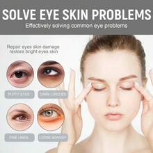 Eye Circles Dark Circles Eye Bags Removal Lifting Firming Smoothing And Removing Fat Particles Skincare Tools - 1 - View 2