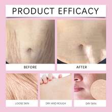 50g Loción de Cuidado Cutáneo Postparto para Mujeres, Limpieza Suave y Humectación Duradera, Nutre Piel Sensible Postparto, Ideal para Cuidado Diario - 50 g - Ver 7