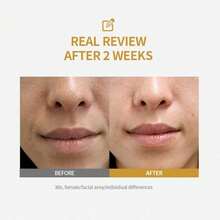 Sérum Ampolla de Colágeno Profundo con Péptidos de Seda, Complejo de Péptidos y Colágeno para Firmeza e Hidratación Instantáneas, Sérum Coreano Ligero para una Piel más Suave y Radiante, con Varita de Masaje para Ojos - Hyaluronic Acid - Ver 5