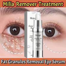 Moisturizing Firming Reducing Fine Lines Dark Circles And Puffiness Removing Fat Particles And Eye Area Skincare Tools - 1 - View 8