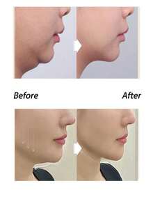 1pc V-Line Face Lifting Strap, Chin Lifting Gel Training Band, Face Lifting Chin Mask, Eliminate Double Chin, Reduce Wrinkles. Can Be Worn During Sleep, At Home, Exercise Or Yoga. - Multicolor - View 6