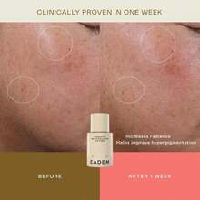 EADEM Gentle Exfoliating AHA &Amp; PHA Toner, Exfoliating Face Serum With Tranexamic Acid, AHA Exfoliant &Amp; Pore Minimizer For Face And Body, Acne Spot Serum, 50 Oz, Cashmere Peel - Trắng - Xem 2