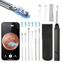 Ear Wax Removal - Earwax Remover Tool With 8 Pcs Ear Set - Ear Canal Cleaner With 1080P Camera - Ear Cleaning Kit With 8 Ear Spoon - Ear Camera For IOS And Android Black - 黑色 - 查看 2