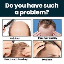 Men's hair conditioner, men's hair nourishing and moisturizing essence. - Aceite - Ver 3