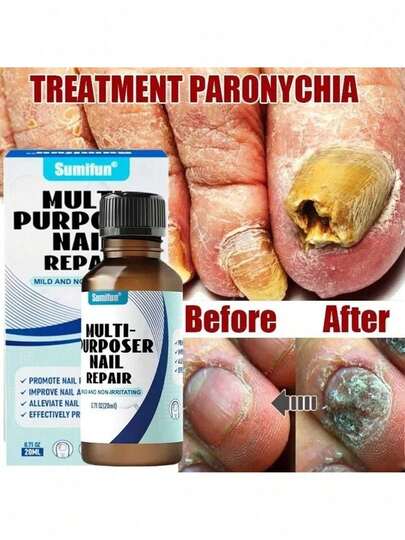 Nail Care Serum, Nail Repair Gel, Toenail Care Serum Nail Care Tools