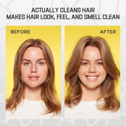 Dry Shampoo - For Quick And Easy Hair Cleaning - Free For All Hair