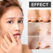 30g,Blackhead Cleansing Mud Mask, Deeply Cleanses The Pores Of The Nose, Quickly Removes Blackheads, Improves Enlarged Pores, Refines And Shrinks Pores, Brightens The Skin, And Controls Oil - 竹炭 - 查看 5