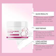 Cuidado de la piel: Limpieza suave, cuidado hidratante y nutritivo para la piel de las mujeres en el posparto; cuidado diario de la piel. - Crema para las estrías - Ver 2