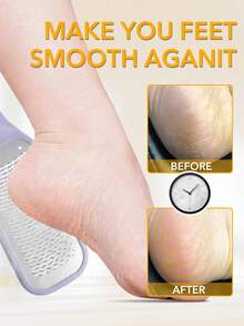 ANDVICTORY 1pc Foot File Callus Remover Foot Rasp Pedicure Scrubber Tool For Feet Care Stainless Scraper Cracked Dead Skin Remover - Multicolor - View 3