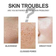 30g,Blackhead Cleansing Mud Mask, Deeply Cleanses The Pores Of The Nose, Quickly Removes Blackheads, Improves Enlarged Pores, Refines And Shrinks Pores, Brightens The Skin, And Controls Oil - 竹炭 - 查看 3