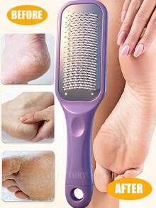 ANDVICTORY 1pc Foot File Callus Remover Foot Rasp Pedicure Scrubber Tool For Feet Care Stainless Scraper Cracked Dead Skin Remover - Multicolor - View 2