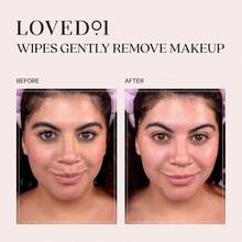Loved01 Face &Amp; Body Salicylic Acid Cleansing Wipes, John Legend Skincare, Oil &Amp; Fragrance-Free, No-Rinse, Suitable For Blemish-Prone Skin, 24 Wipes - ColorB - 查看 4