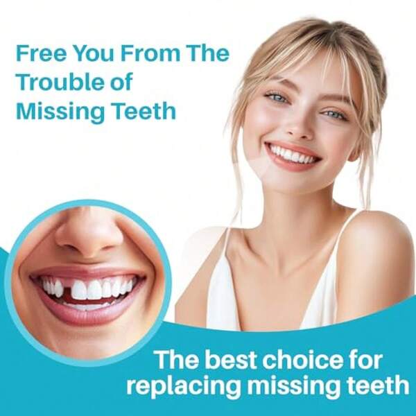 Moldable Dental Gum Temporary Tooth Repair & Filling & Decoration Kit,Cavity Repair Kit For Cavities & Gaps  Makeup & Costume Accessories For Covering Gaps & Cavities, M6DQ