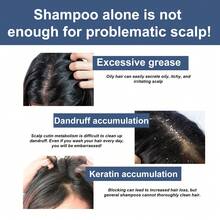 100g,Scalp Scrub, Deeply Cleanses Scalp Keratin, Improves Oil Secretion, Repairs Split Hair Frizz, Refreshing Hair Care, Promotes Hair Health, Increases Hair Luster, And Softens Hair Care Scrub - 頭皮磨砂膏 - 查看 4